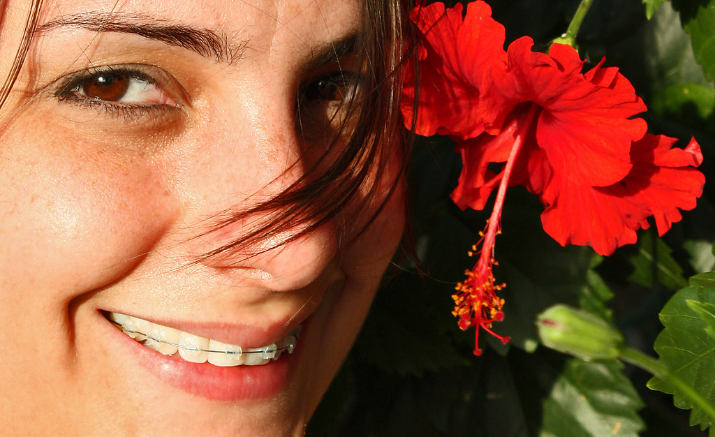 Invisalign Marketing: How Dental Practices Get More Aligner Cases (2026)